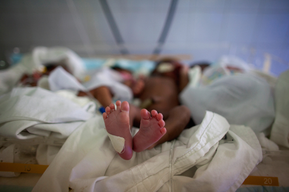 200 babies need heart surgeries every year in Ghana